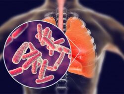 Wakil Ketua Komisi IV DPRD Kaltim Mendorong Pencegahan dan Penanganan Tuberkulosis